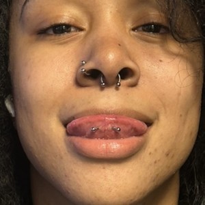 Img 1992