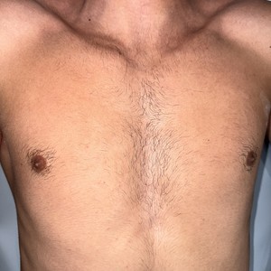 Chest wax 3