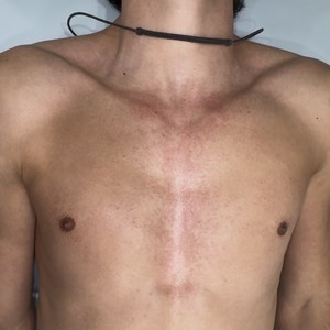 Chest wax 4