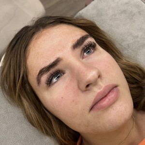 Img 7714