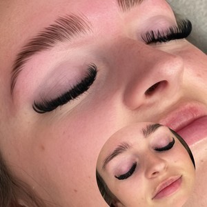 Img 1378