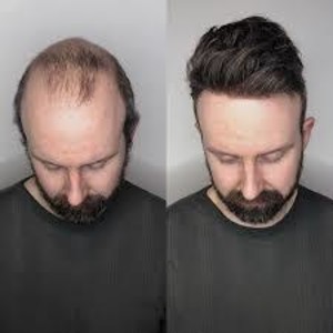 Hairsystem2