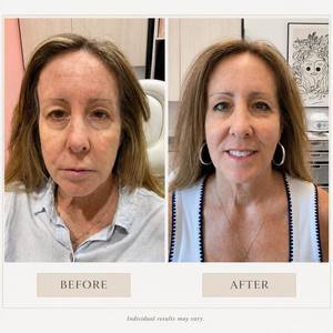 Clinical beauty before after salon lofts tiny