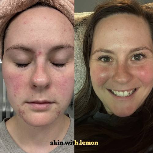 Neutral minimalist skincare before and after instagram post