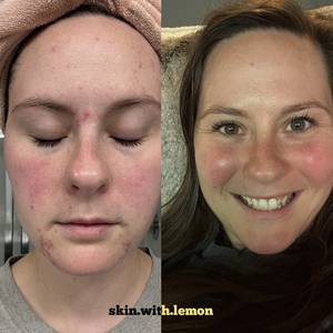 Neutral minimalist skincare before and after instagram post