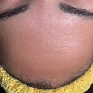 Img 0213