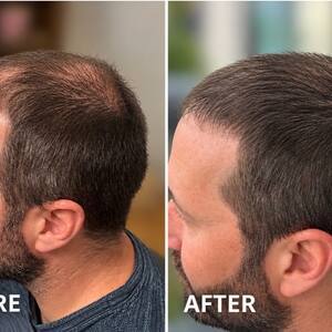 Img 5118