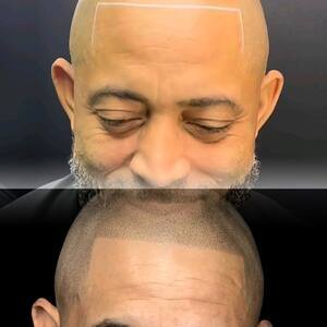 Camerarolltempimage