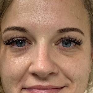 Img 4326