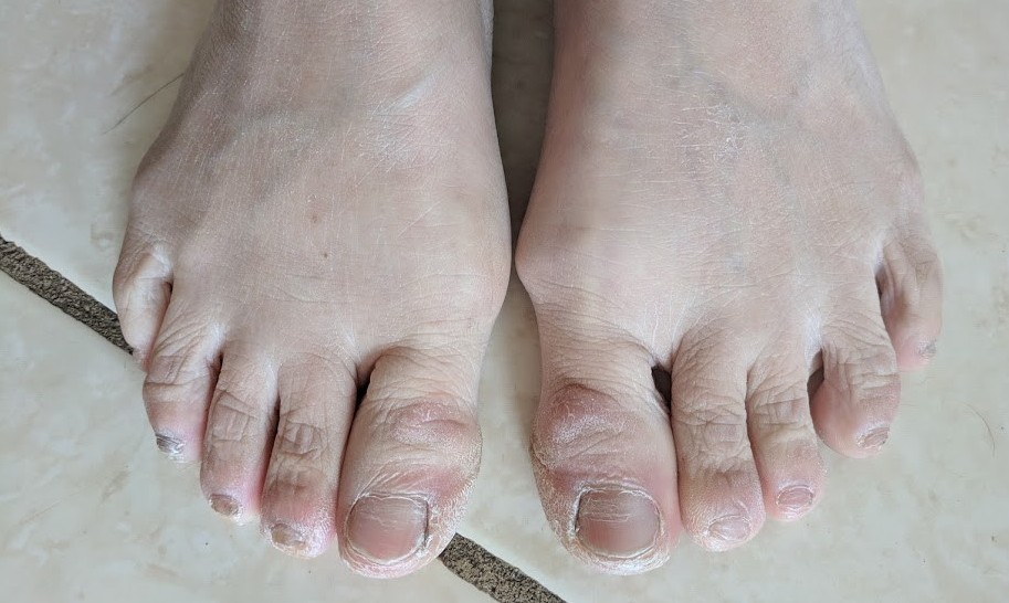 knarly feet