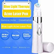 Blue light therapy for acne