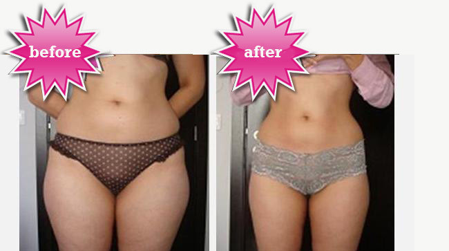 before and after
