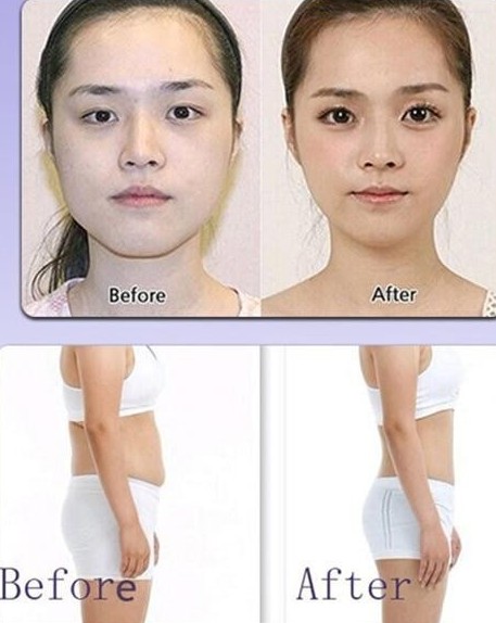 weight reduction on face after doing infrared light therapy