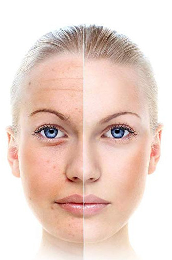 red light therapy on face