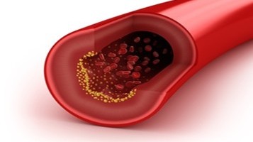 dilation of blood vessels