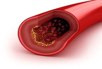 blood vessel permeability due to infrared red light therapy