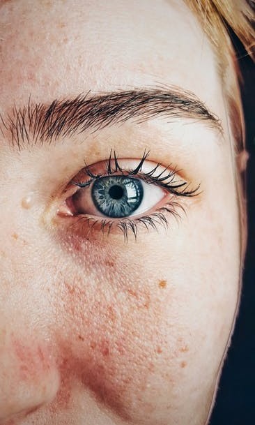 skin problem psoriasis skin problem psoriasis