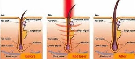 red light therapy for skin diagram
