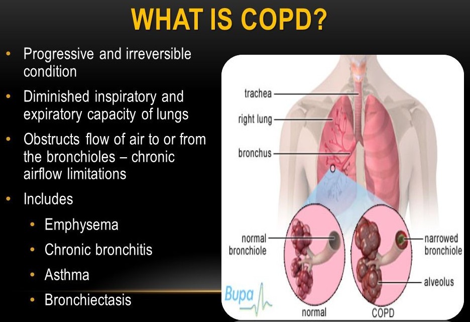 C.O.P.D. is breathing for life