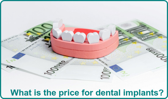 What is the price for dental implants image