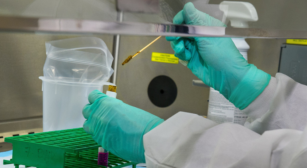 Serrapeptase enzyme studies Serrapeptase enzyme studies