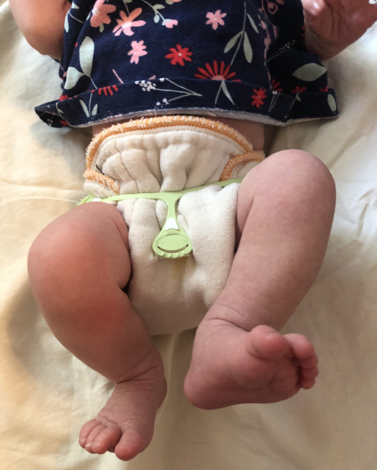 are newborn cloth diapers worth it? are newborn cloth diapers worth it?