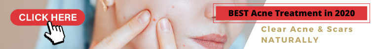 Buy acne no more