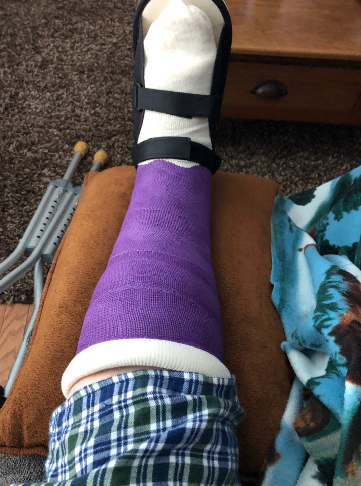 a life of injuries - me in a cast a life of injuries - me in a cast