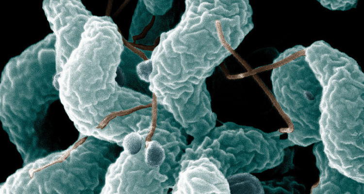 Campylobacter - Chickenmethod.com Campylobacter - Chickenmethod.com