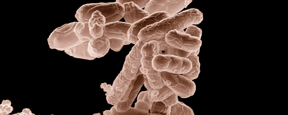 Escherichia coli. (2023, April 27). In Wikipedia. https://en.wikipedia.org/wiki/Escherichia_coli - Chickenmethod.com Escherichia coli. (2023, April 27). In Wikipedia. https://en.wikipedia.org/wiki/Escherichia_coli - Chickenmethod.com