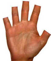 Raise your hand if you are for De-Claweing your ca Raise your hand if you are for De-Claweing your ca