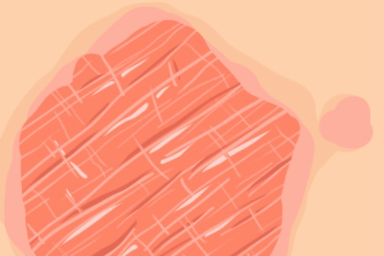 Here Are The 7 Most Common Types Of Eczema And How To Treat Each One