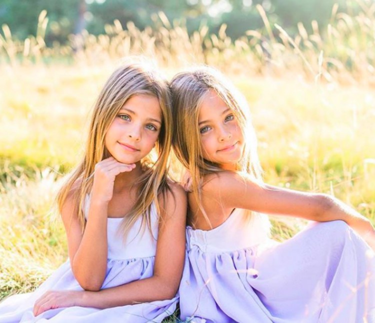 They Were Called The Most Beautiful Twins In The World. Here’s What