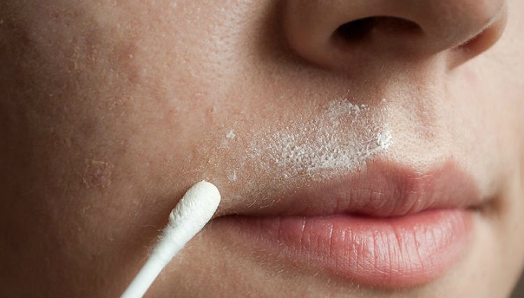 10 Diy Facial Hair Removal Techniques That Don T Involving