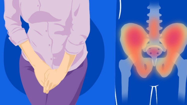 7 Pelvic Pains That You Should Never Ignore And What They Mean For Your Health
