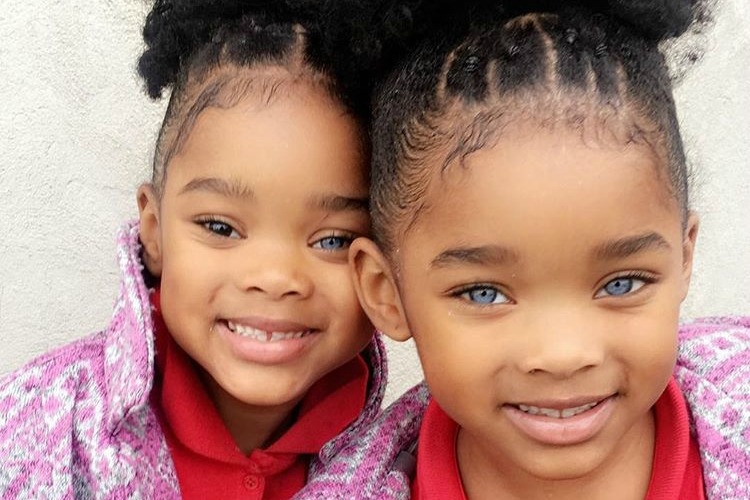 These Children Became Famous Worldwide Because of Their Undeniable Beauty