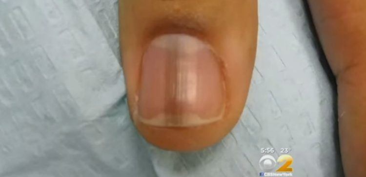 Black strip 2024 on nail