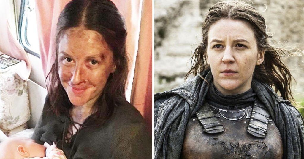 Fans Are Going Nuts Over This ‘Game of Thrones’ Actress Breastfeeding