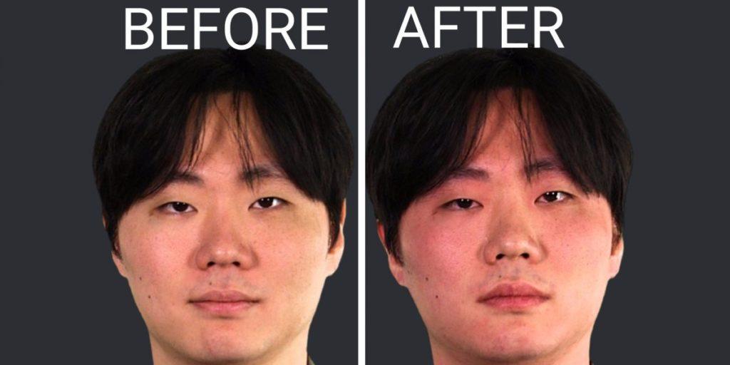 Why You Get Rosy Cheeks After a Drink