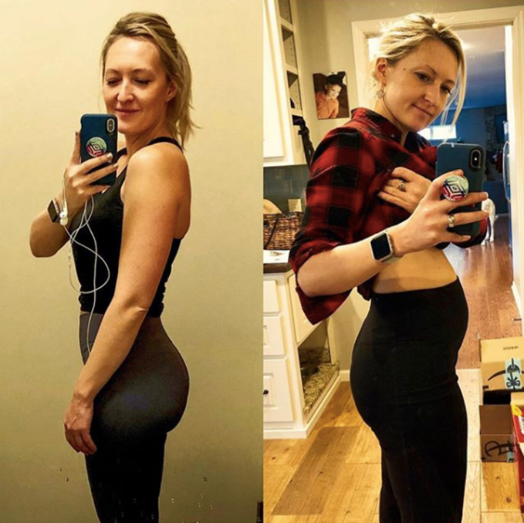 Women Share Their ‘Endo Bellies’ to Highlight a LittleKnown