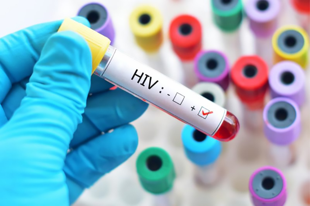 HIV: m&Atilde;&copy;dicos anunciam 4&Acirc;&ordm; caso de cura no mundo - Portal do Marcos Santos