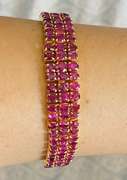 47.0 CT Ruby Bracelet in 18kt Solid Yellow Gold!