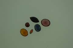 11.24 Garnet Loos Stone Lot