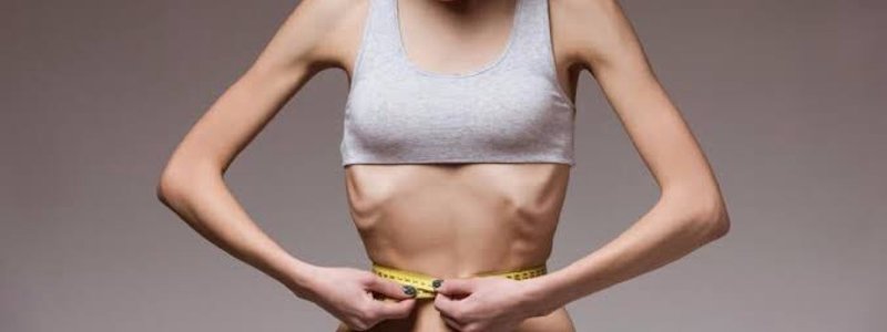 Test de anorexia