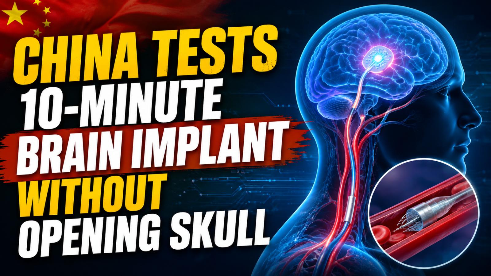China Tests 10-Minute Brain Implant Without Opening Skull