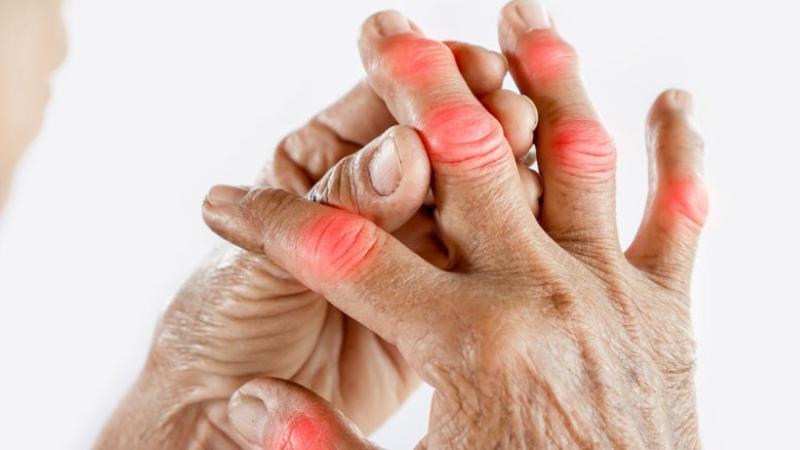 10 Health Problems Caused by High Uric Acid Levels