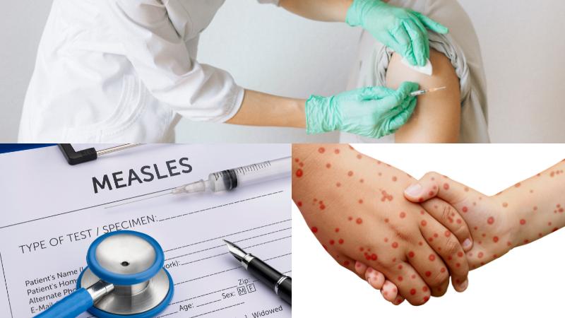Possible Measles Exposure in San Antonio Health Officials Issue Warning
