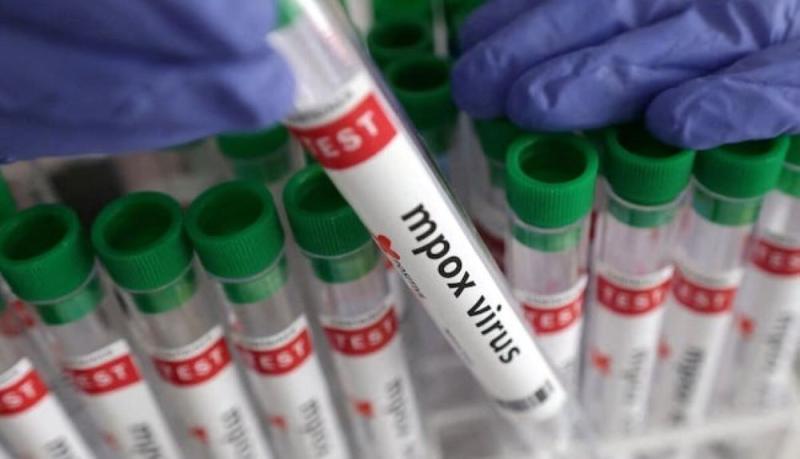 Another Mpox Case Reported in Kerala: Health Department Urges Vigilance and Treatment