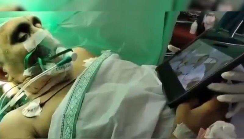 Awake Craniotomy in Andhra Pradesh Patient Watches Jr. NTR Film During Brain Surgery
