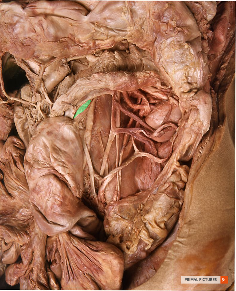 Inferior mesenteric vessels viewed from the front